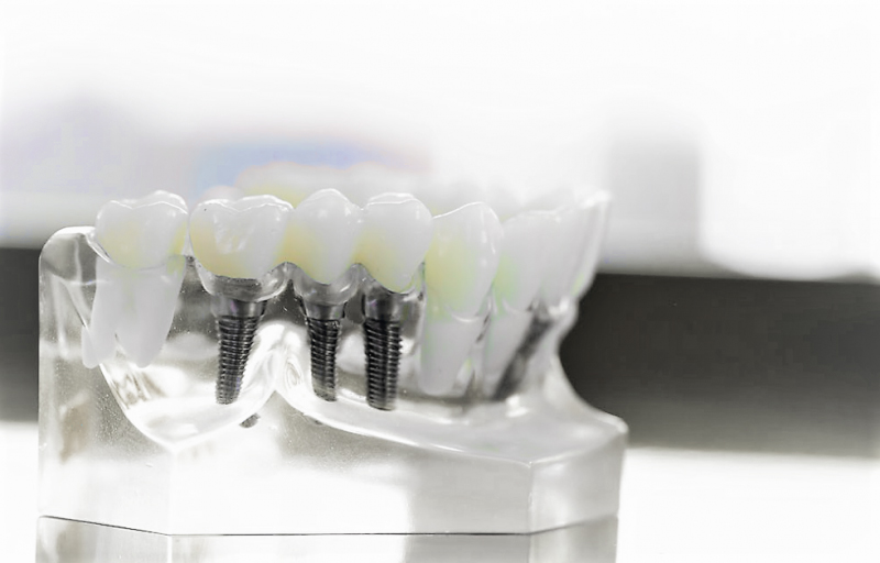 хирургическая стоматология в Минске